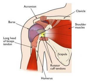 Illustration of shoulder anatomy highlighting rotator cuff tendons, acromion, bursa, and associated muscles, relevant to shoulder tendonitis and impingement.