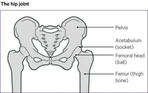 Illustration of the hip joint anatomy, labeled with key components: pelvis, acetabulum (socket), femoral head (ball), and femur (thigh bone), relevant to understanding hip osteoarthritis.