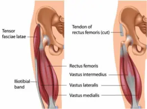 Illustration of quadriceps muscles, including rectus femoris, vastus intermedius, vastus lateralis, and vastus medialis, labeled for anatomy education related to quadriceps muscle strains and physical therapy treatment.